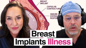 Why Your Body Rejects Breast Implants | Dr. Robert Whitfield